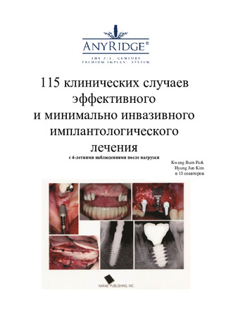 115 клинических случаев AnyRidge. Книга